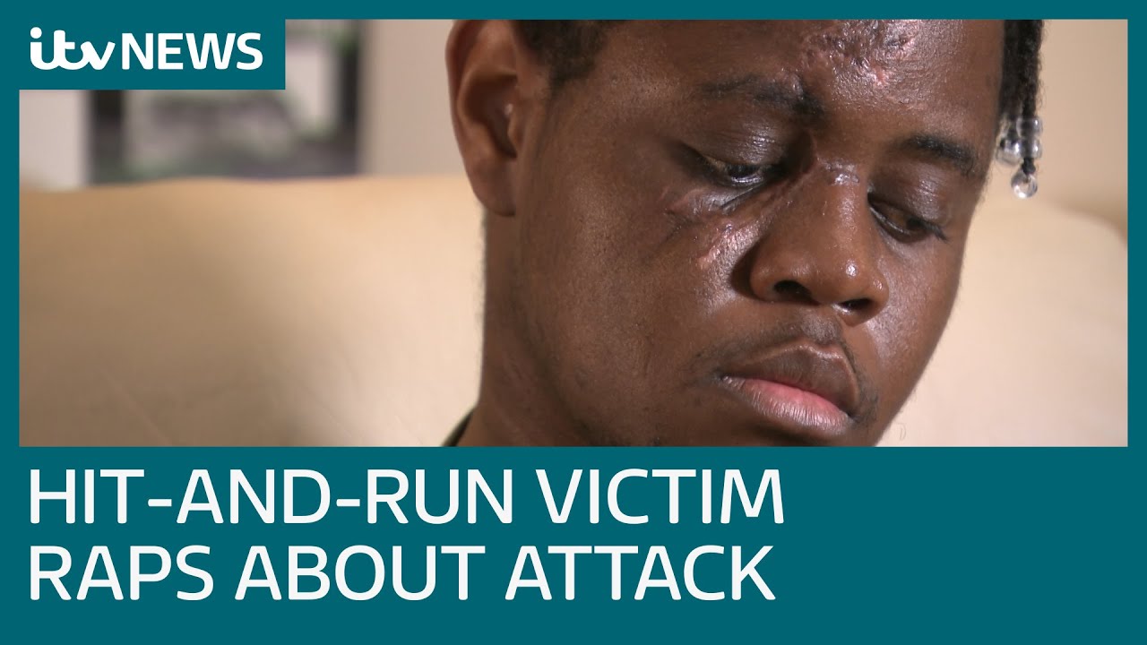 Why the Bristol NHS hitandrun victim is rapping about his attack