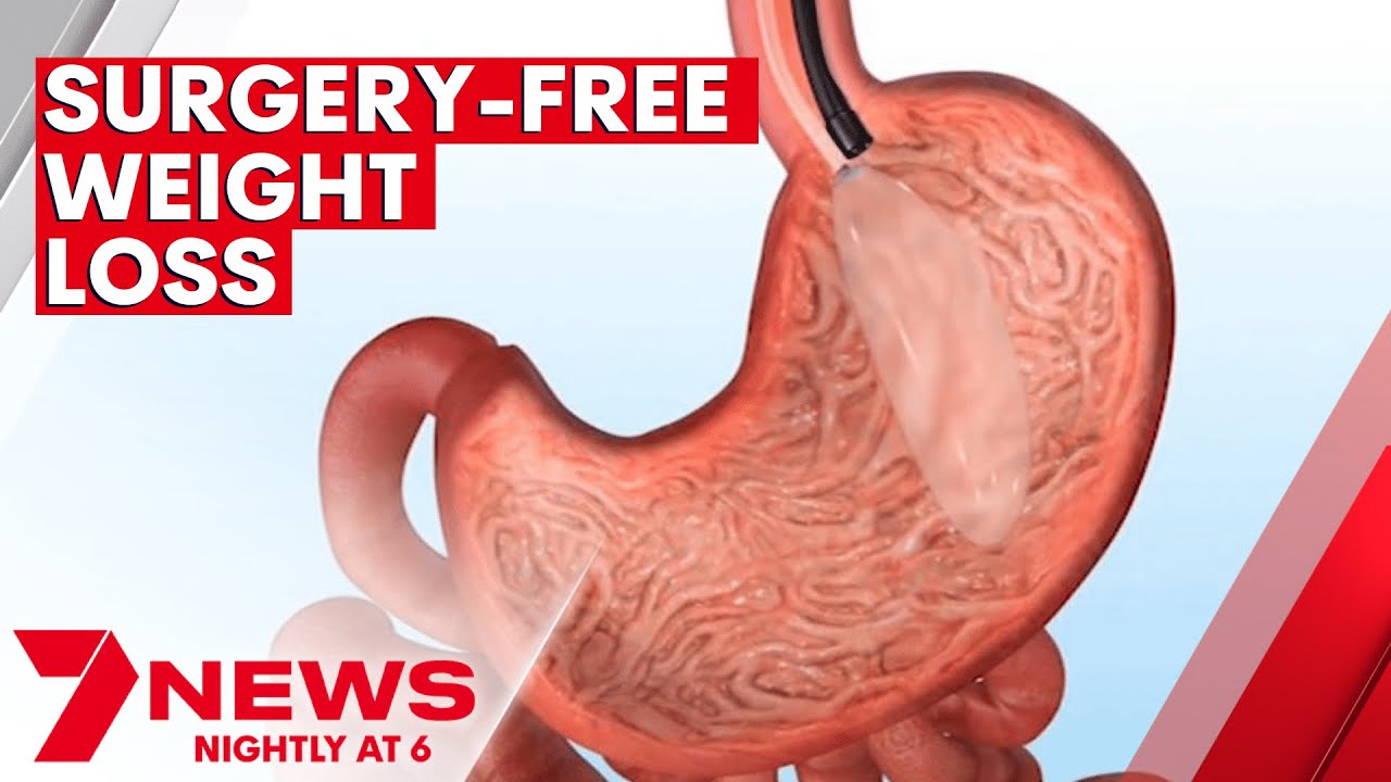 Elipse gastric balloon weightloss device approved for use in Australia
