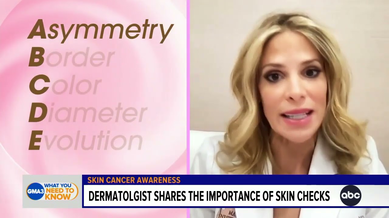 What you need to know about skin cancer The Global Herald