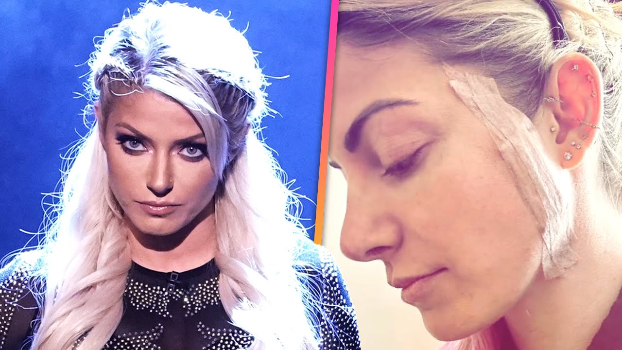 Alexa Bliss Reveals Skin Cancer Diagnosis Amid WWE Absence The Global