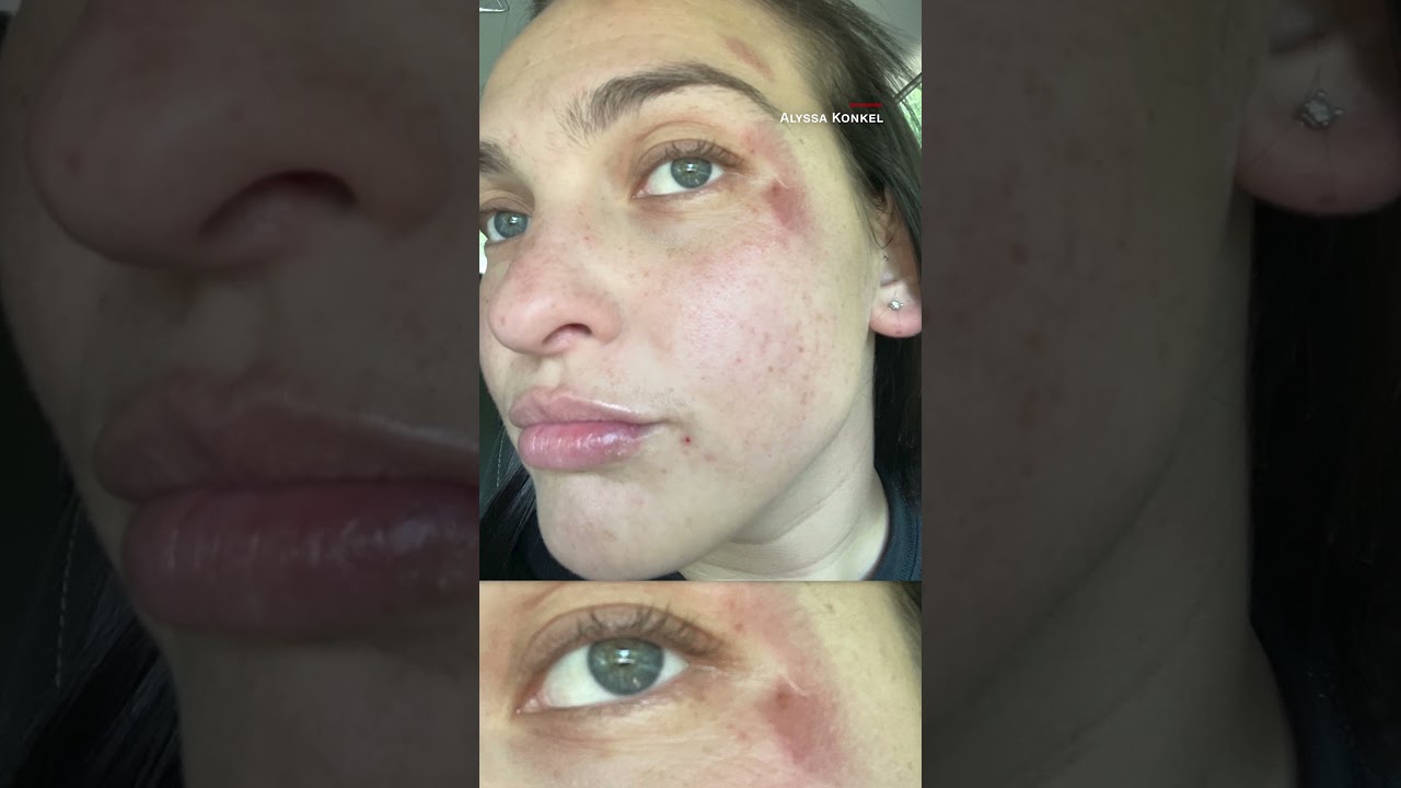 Woman loses pants on treadmill The Global Herald