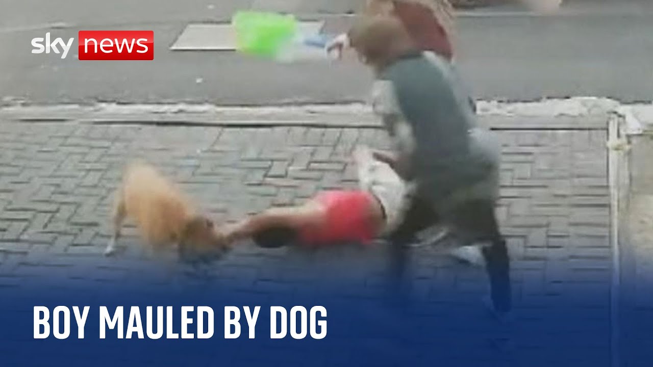 Doorbell cam captures moment boy is mauled by dog while playing ...