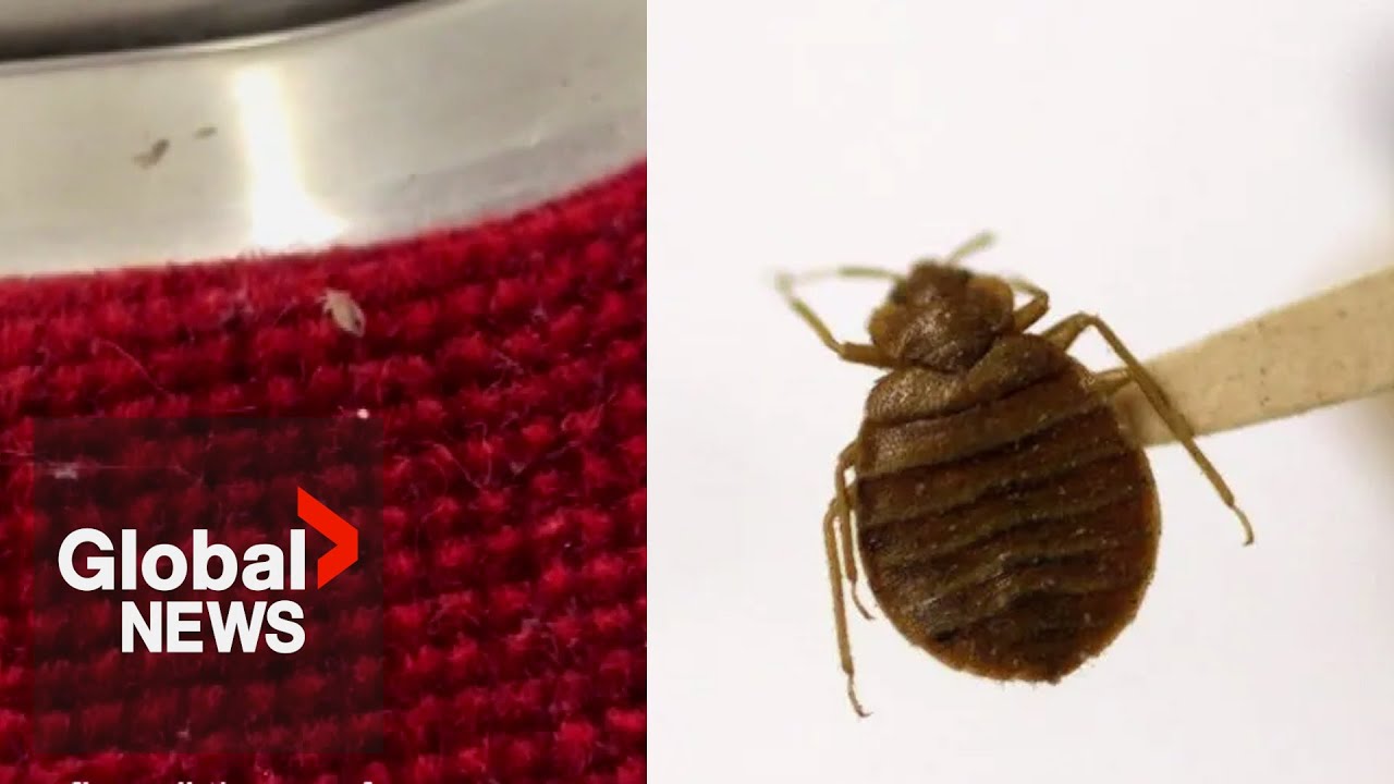 Bed bug on Toronto public transit possibly caught on viral video The